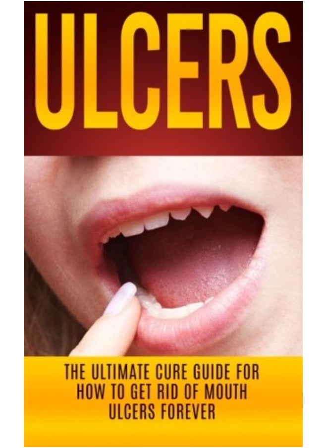 Ulcers The Ultimate Cure Guide For How To Get Rid Of Mouth Ulcers Instantly 