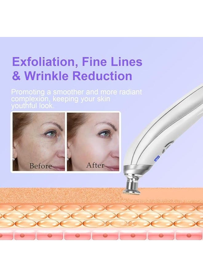 Microdermabrasion device, rechargeable suction-type microdermabrasion facial treatment, comes with 9 diamond microdermabrasion attachments, suitable for professional skincare salons and home use (white). - Image 2