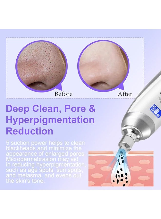 Microdermabrasion device, rechargeable suction-type microdermabrasion facial treatment, comes with 9 diamond microdermabrasion attachments, suitable for professional skincare salons and home use (white). - Image 3