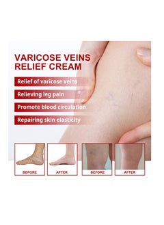SOUTH MOON South Moon Vein Repair Cream Massage Varicose Relief Cream  - Image 2