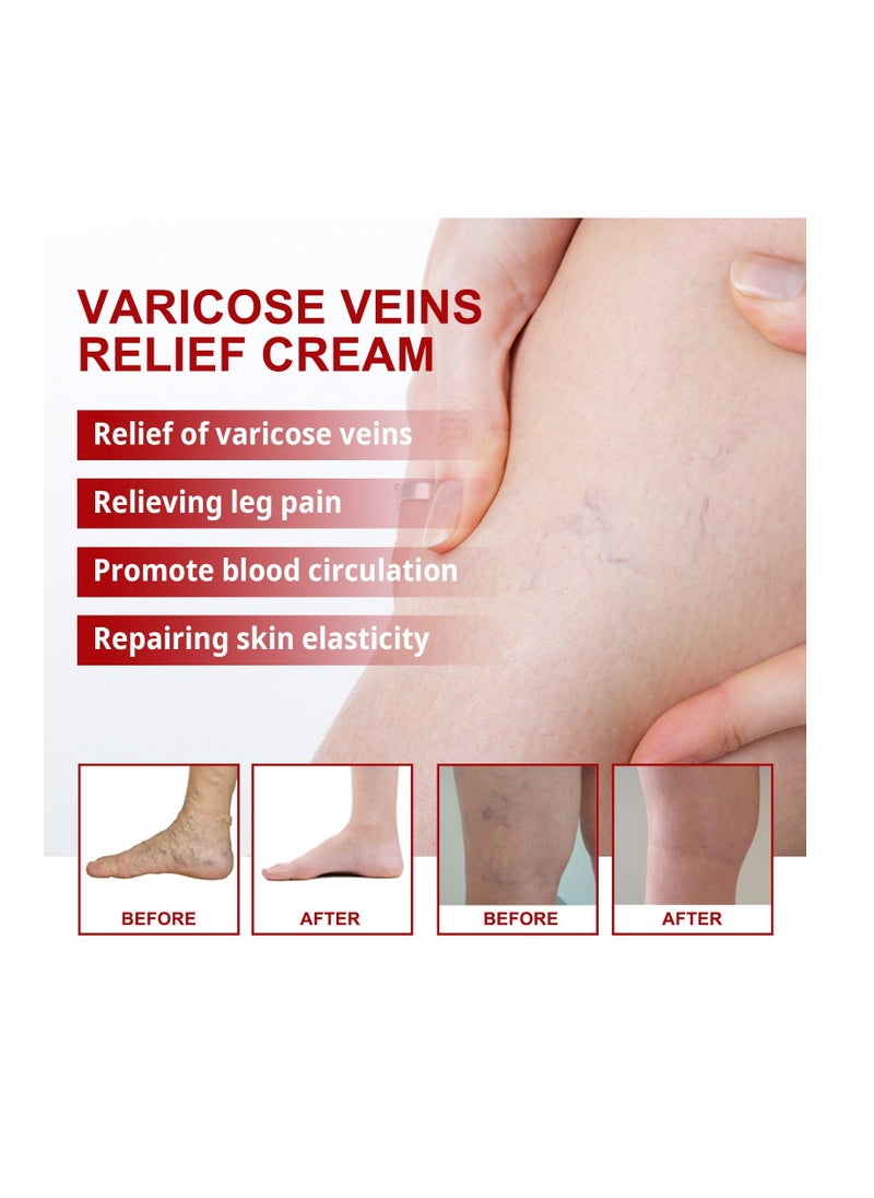 SOUTH MOON South Moon Vein Repair Cream Massage Varicose Relief Cream  - Image 2