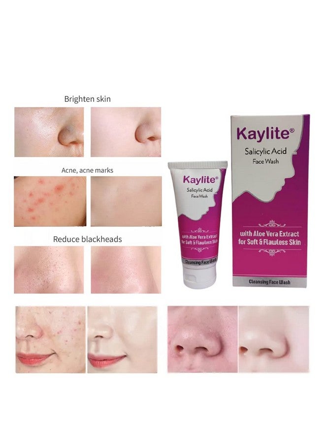 Kaylite Salicylic Acid Face Wash With Aloe Vera Extract For Soft And Flawless Skin (Pack Of 2) 60 Ml - Image 5