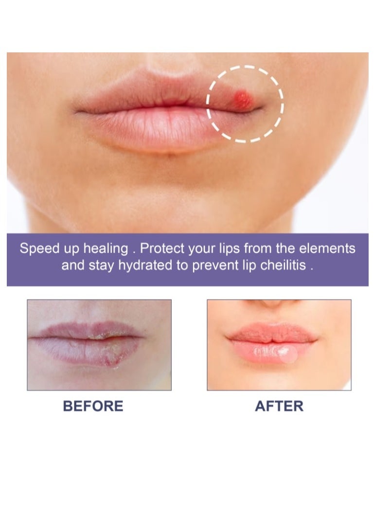 EELHOE Lips Care Pimple Patches,Lips Acne Hydrocolloid Patches,Lips Care Spot Patches,Lips Clear Patches,Invisible Lip Acne Healing Patch Repair Lip Condition,36Pcs - Image 2