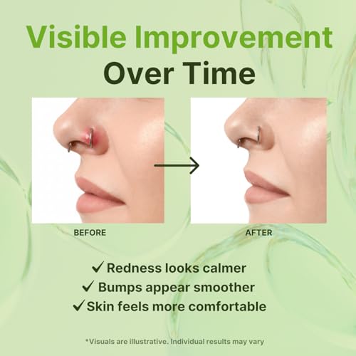 Tobcharm Piercing Bump Solution – Piercing Bump for Ear, Nose & Body – Soothes Keloid Bumps, Reduces Redness & Irritation, Promotes Healing – 15ml - Image 3