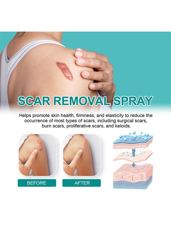 SOUTH MOON - Medical Grade Scar Spray for Reduce Scars and Smooth Skin, Smoothing Skin Care Mist Moisturizes The Skin, Smooth And Translucent Mist 20g - Image 1