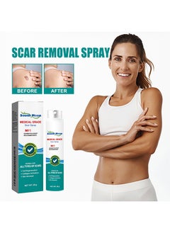 SOUTH MOON Medical Grade Scar Spray for Reduce Scars and Smooth Skin, Smoothing Skin Care Mist Moisturizes The Skin, Smooth And Translucent Mist 20g  - Image 1