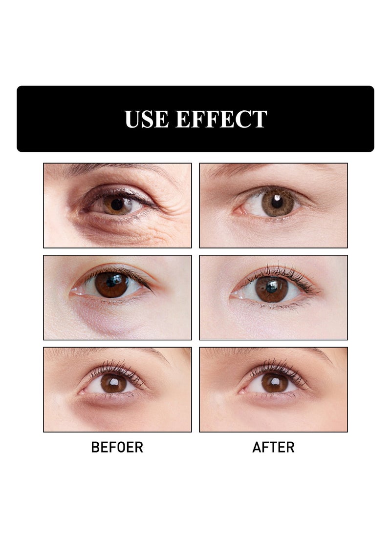 Jaysuing - Snake Venom Peptide Firming Eye Skin Repair Cream Fade Fine Lines Remove Under Eye Bags Moisturizer 30g - Image 1