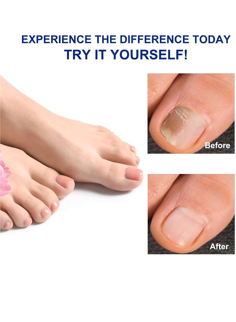 Sefudun 32 قطعة من رقعة فطريات الأظافر، رقعة إصلاح الأظافر الليلية لعلاج تلف فطريات الأظافر، تجدد بنية الأظافر وتحسن لونها، رقعة فطريات الأظافر المتجددة ليلاً لمدة 8 ساعات - Image 2