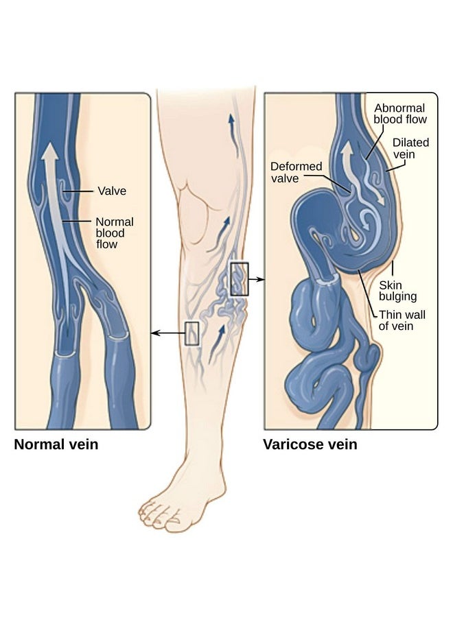 SIGMACEUTICAL - Varicose Vein Treatment Leg Circulation Supplement Diosmin Leg Vein Support Circulation Vein Support Healthy Leg Vein Supplement 90 Capsules - Image 1
