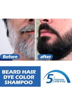 East Moon Men's Black Beard Dye, Mustache & Beard Dye For Men, Black Hair Dye for Gray Hair Coverage, 3 in 1 Hair Dye Shampoo, Quick & Easy to Use at Home, Long Lasting Beard Color for Men 100ML (Black)  - Image 4
