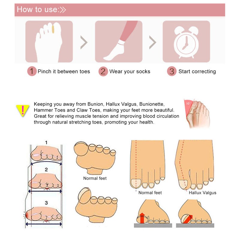 1 Pair Silicone Hallux Valgus Toe Separator Stretcher Toe Overlapping Spreaders Toe Spacer Straightener Bunion Corrector - Image 3