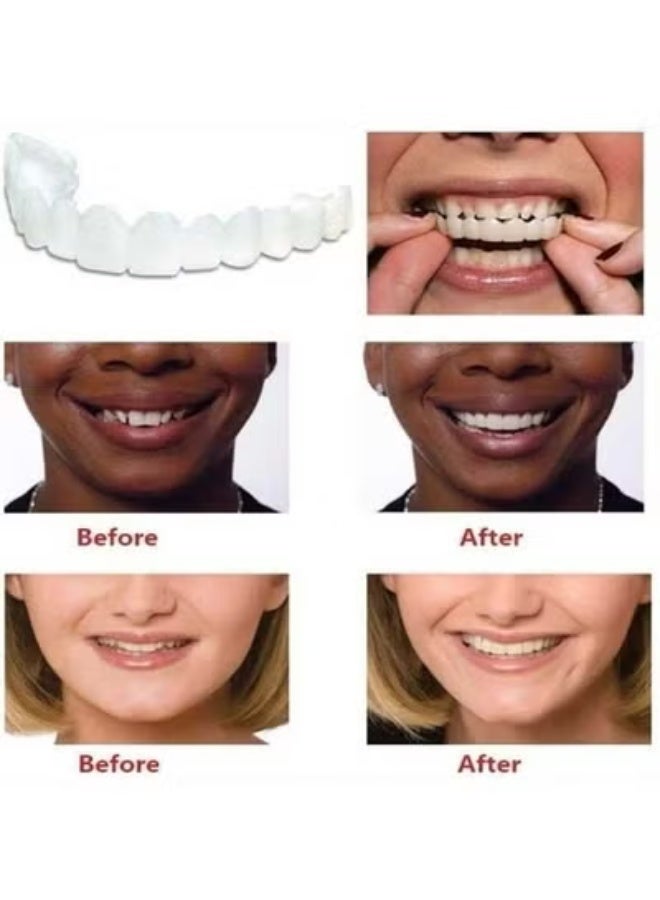 Upper and Lower Teeth Simulation Braces Snap Second Generation Simulation Braces Silicone Whitening Dentures - Image 4