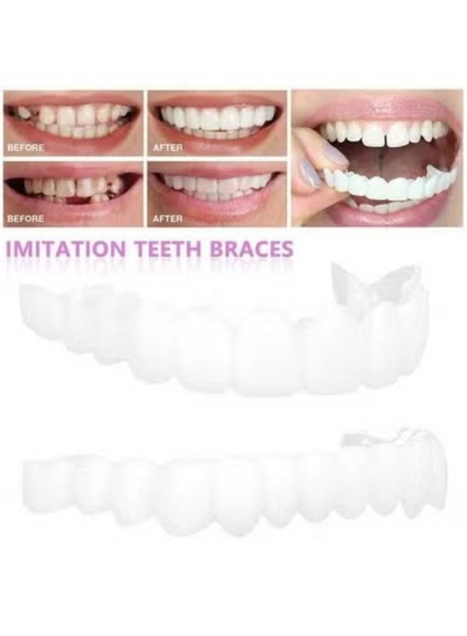 Upper and Lower Teeth Simulation Braces Snap Second Generation Simulation Braces Silicone Whitening Dentures - Image 3