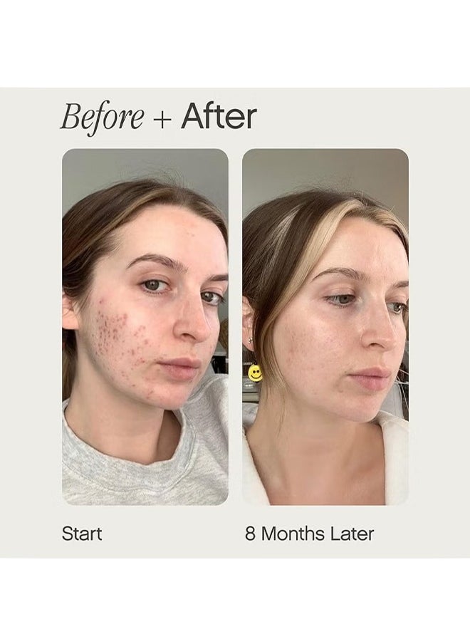 TOPICALS Topicals Brightening and Clearing Serum | Reduces Discoloration, Post-Blemish Marks, Scars and Spots | Contains Kojic Acid and Niacinamide | Dermatologist-tested, Vegan, Cruelty-Free （15ml）  - Image 3