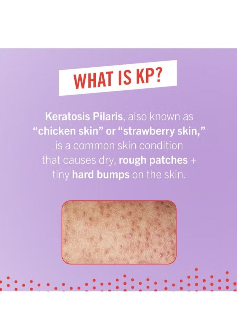 First Aid Beauty - First Aid Beauty KP Bump Eraser Body Scrub Exfoliant for Keratosis Pilaris with 10% AHA - Image 1