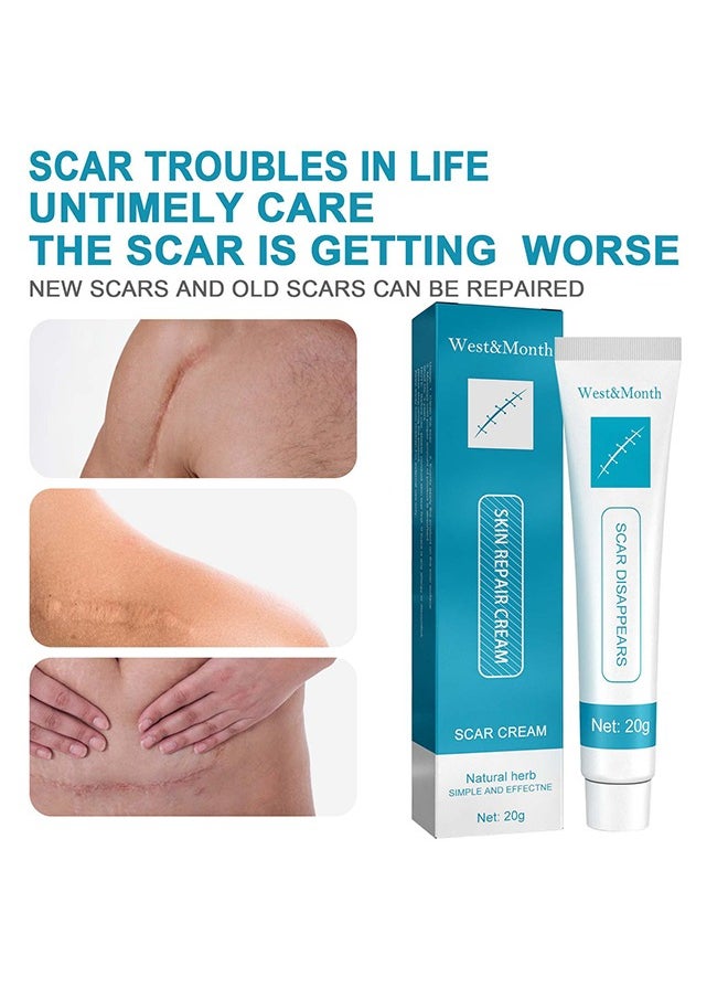 West&Month Scar repair cream - dilute hyperplasia pregnancy surgery burn scald skin repair scar cream 20g  - Image 3