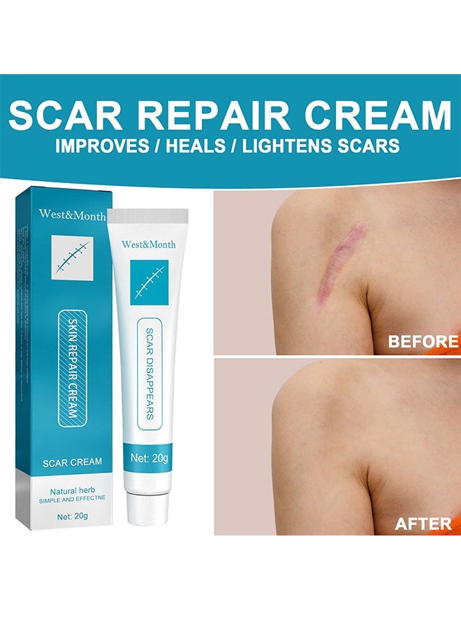 West&Month Scar repair cream - dilute hyperplasia pregnancy surgery burn scald skin repair scar cream 20g  - Image 5