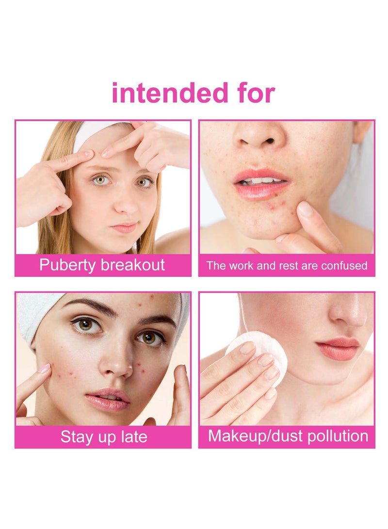 EELHOE Pimple Patch for Face, Repair Acne Pimples Closing Acne Marks Moisturizes And Improves Skin Elasticity, Cute Colorful Butterfly Shape Spot Stickers for Skin Care(160 Counts) - Image 5