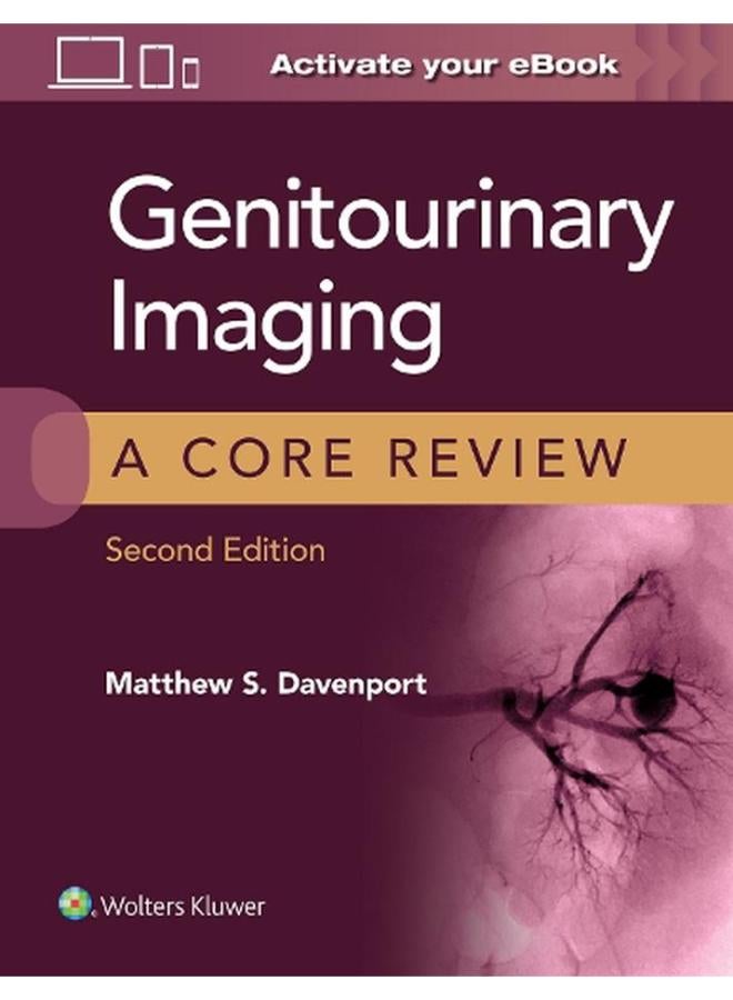 Genitourinary Imaging  A Core Review  Ed   2 