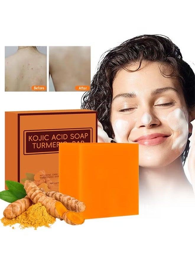 CARVENCHY Kojic Acid Soap Turmeric Bar, Anti-Acne Dark Spot Corrector Soap, Brightning Deep Cleansing Face And Body Turmeric Soap, Tretinoin Soap, Acne Facial Turmeric Kojic Acid Soap Bar - Image 1