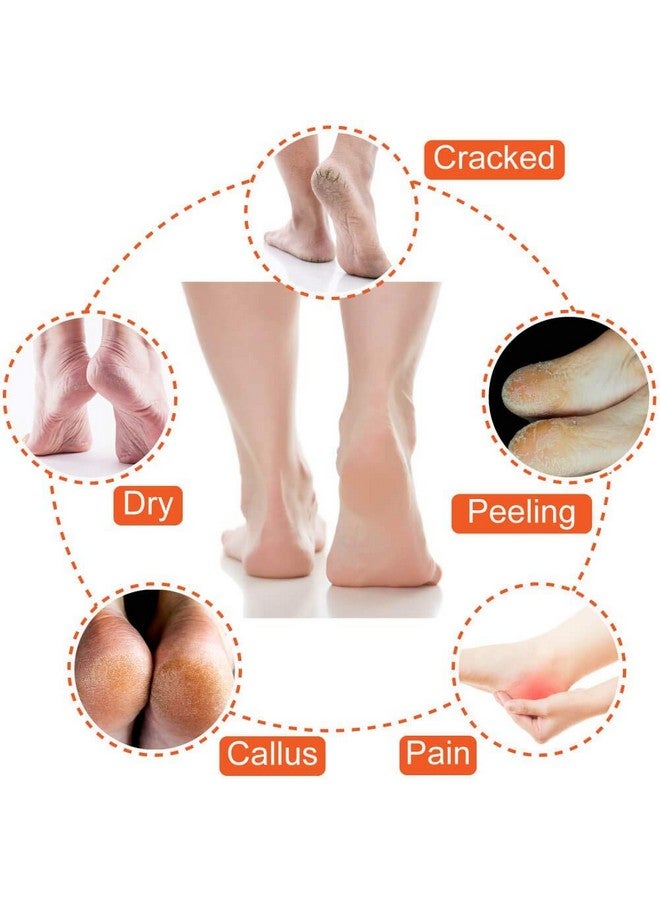 Fodgo Fodgo 2 Pair Moisturizing Gel Heel Socks Open Toe Socks For Dry Hard Cracked Heels Gel Pad for Dry Hard Crack and Pain Relief for Men and Women Swelling & Pain Relief, Cushion Support (Multicolor) - Image 4