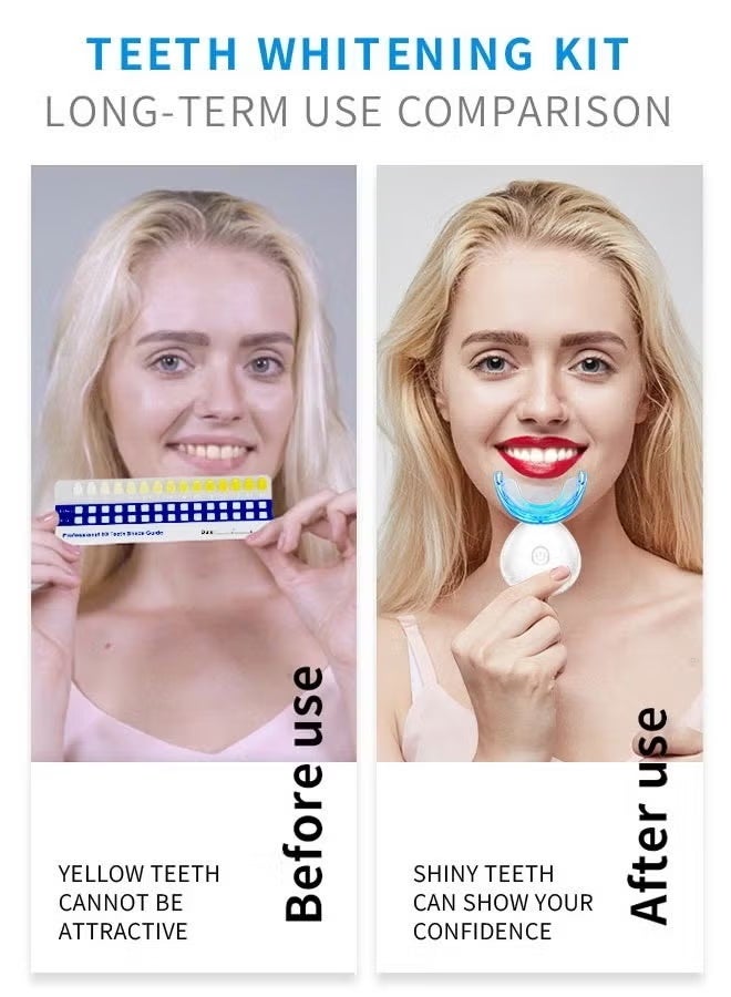 SMILEKIT Teeth Whitening Kit, Portable Wireless Teeth Whitening Device with Gel Pens and LED Lights Accelerator Effective Removal Coffee Smoking Stains, Yellow Teeth - Image 2