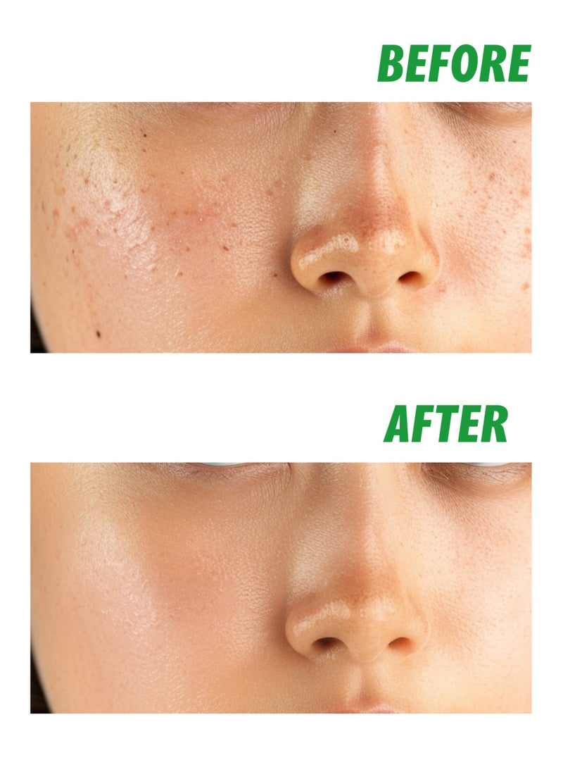 nightingale Korean Hydrating Teatamin Facial Essence 200ml with Tea Tree & Vitamins  - Image 4