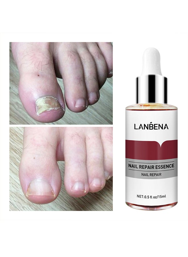 LANBENA - LANBENA Nail Repair Essence - Image 1