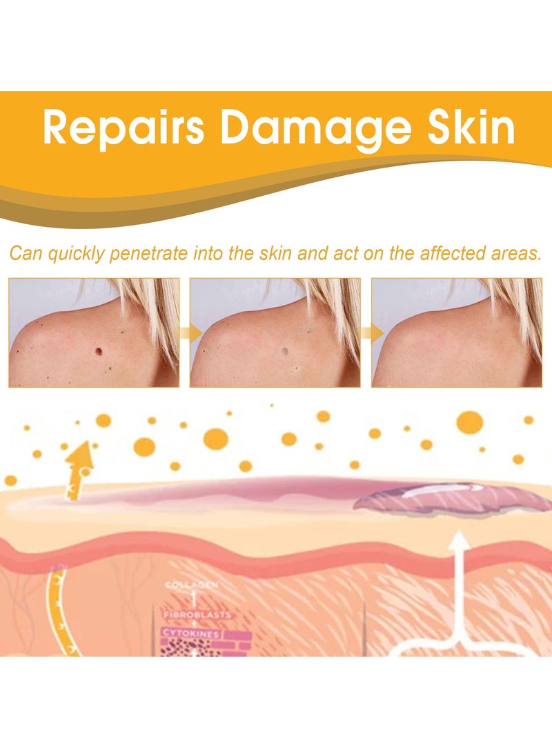 ximonth Skin Tag Removal Spray Tag Recede Bee Venom Spray, Bee Venom Warts and Button Removal Treatment Spray, TagRecede Bee Venom Treatment Spray Against Warts 20mlOil  - Image 3