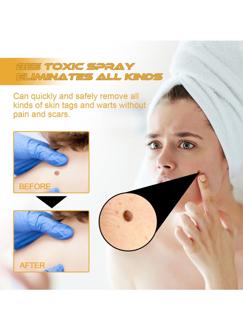 ximonth Skin Tag Removal Spray Tag Recede Bee Venom Spray, Bee Venom Warts and Button Removal Treatment Spray, TagRecede Bee Venom Treatment Spray Against Warts 20mlOil  - Image 4