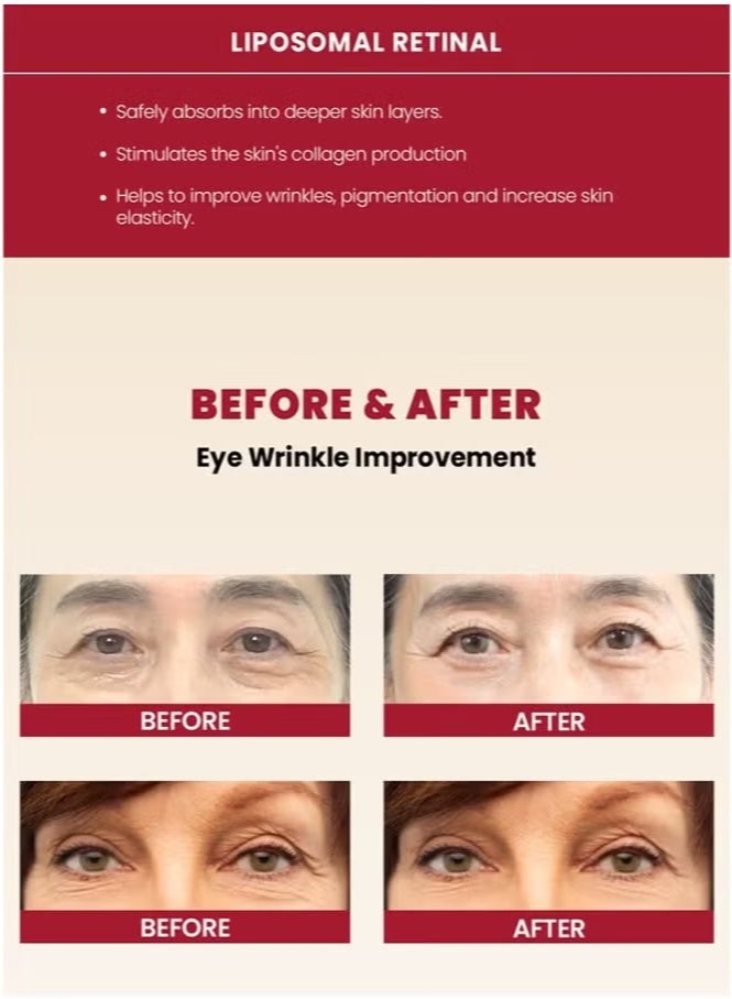 SEOUL 1988 SEOUL 1988 Anti-Aging Duo – Retinal Liposome Serum + Eye Cream, 2% Ginseng & 4% Fermented Extract, Korean Formula - Image 5