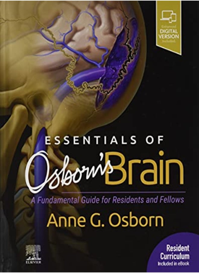 Essentials Of Osborns Brain 