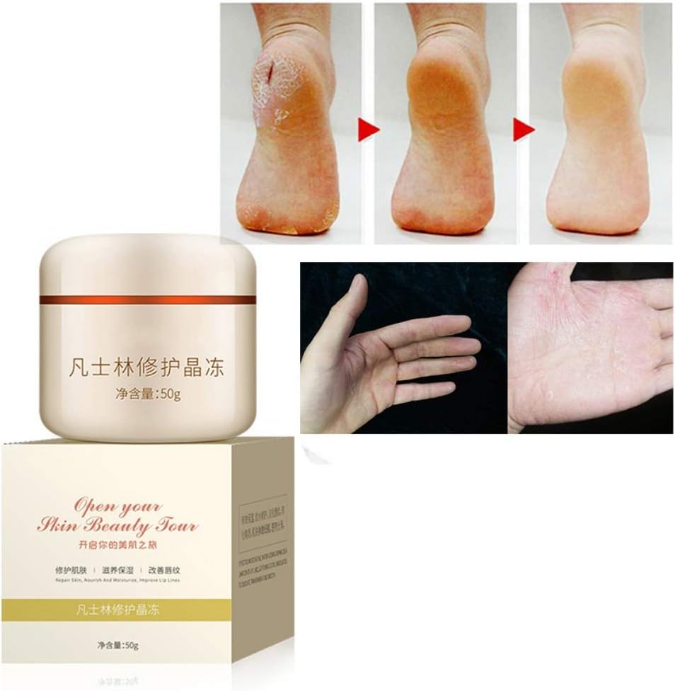 woobles Repair Cream Moisturizing Lighten Lip Lines Repair Skin Body Cream Anti Aging Lightening Nourishing Hydrating Moisturizer, Firming Skin Lighten Fine Lines Brighten Skin Color 1PC