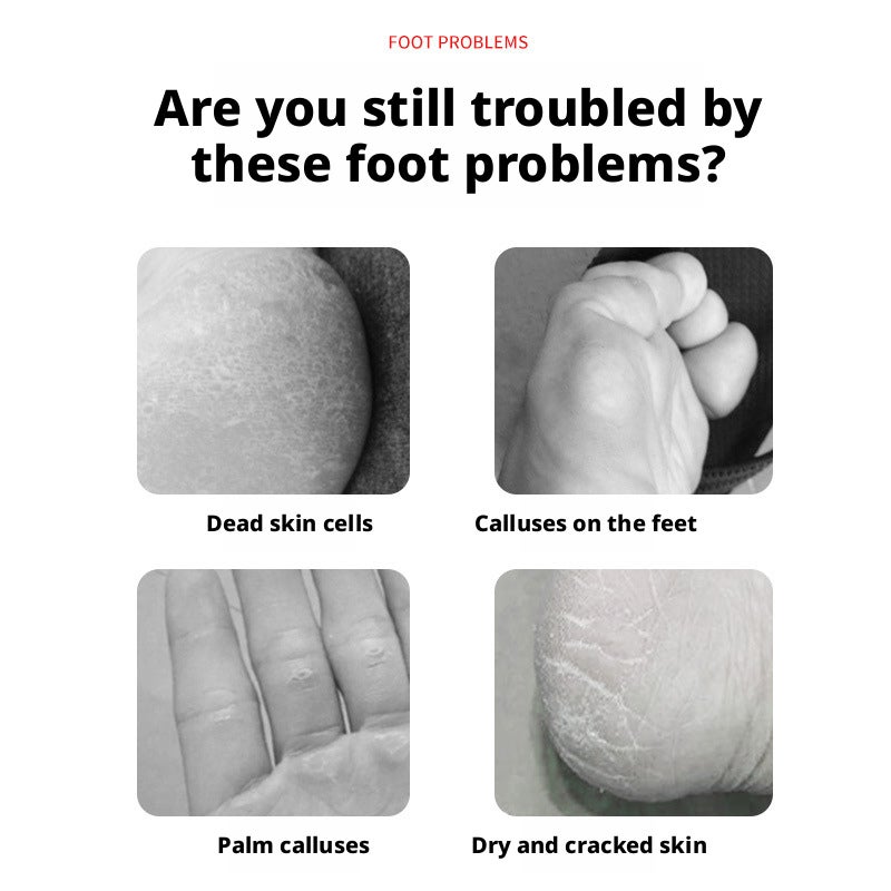 Foot Care Set - Callus Remover & Dead Skin Scraper Kit - Image 2