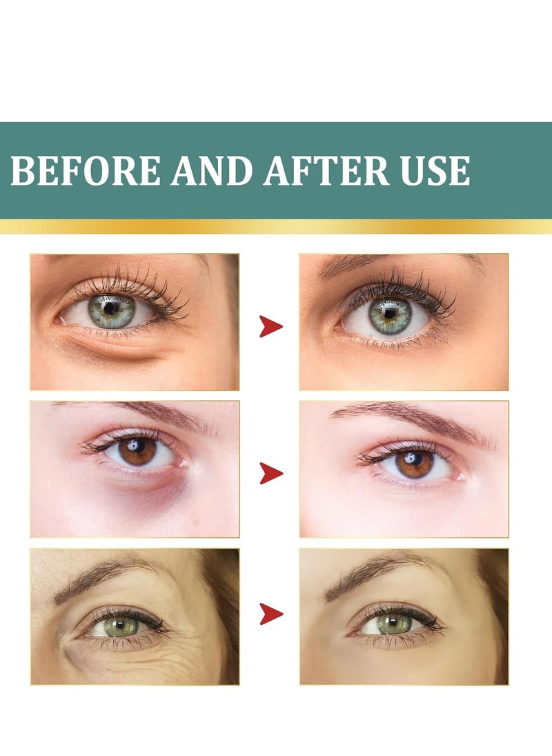 إيلهو كريم Revitalize Eye ، بلسم طبيعي وعضوي مضاد للشيخوخة للعين ، كريم تحت العين فوري يقلل من الانتفاخات تحت العين ، الهالات السوداء والانتفاخ مع معجون الياسمين والصبار ، بشرة مشدودة تحت عينيك 100 مل  - Image 3