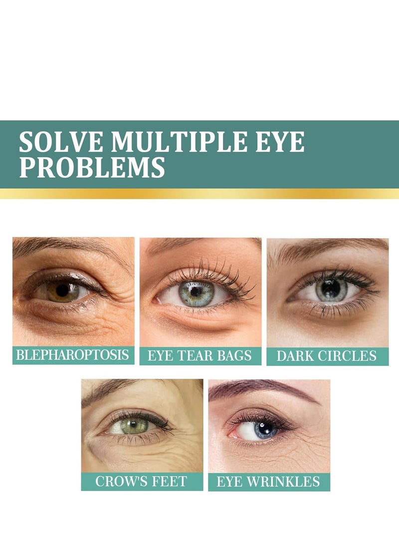 إيلهو كريم Revitalize Eye ، بلسم طبيعي وعضوي مضاد للشيخوخة للعين ، كريم تحت العين فوري يقلل من الانتفاخات تحت العين ، الهالات السوداء والانتفاخ مع معجون الياسمين والصبار ، بشرة مشدودة تحت عينيك 100 مل  - Image 4