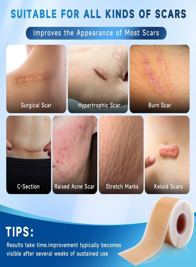 Rvlaim UPF50+ Silicone Scar Sheets with UV Protection(1.8”x 157" Roll Reusable Sheets to Soften, Flatten Fade Scars, Reduce Redness for Surgical, C-Section, Burn, Keloid, and Hypertrophic Scars - Image 5