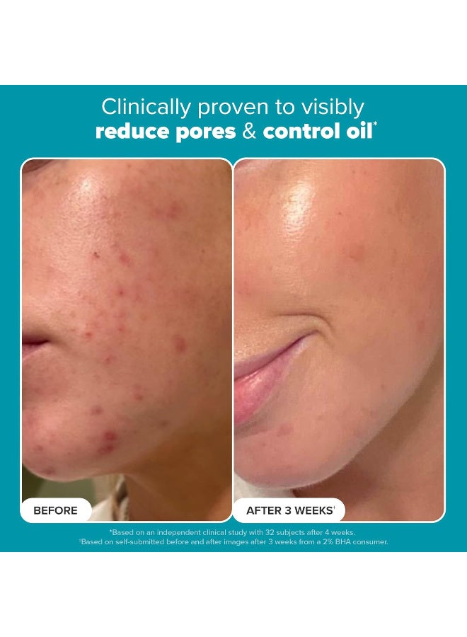 PAULA'S CHOICE Skin Perfecting 2% Bha Liquid Salicylic Acid Exfoliant for Blackheads and Enlarged Pores