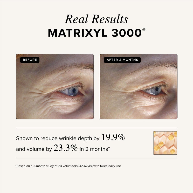 Asterwood Triple Repair Matrixyl 3000 + Argireline + Hyaluronic Acid + Vitamin C Serum for Face - Anti-Aging, Collagen Boosting, Hydrating - Fragrance-Free - 8 Fl Oz - Image 5