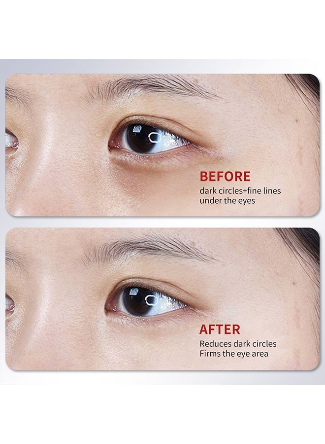 Youbuy كريم عين بكافيين متعدد التأثيرات، كريم للعين لمكافحة تجاعيد الهالات السوداء والانتفاخ، وكريم مرطب لمنطقة تحت العين يحتوي على حمض الهيالورونيك والريتينول، كريم رفع وشد للعين - Image 4