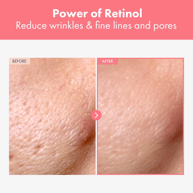 NATUREKIND Repair Retinol Cream, Liposomal Retinol 0.1%, Bakuchiol, Retinal, niacinamide, Anti Aging for Face, Eye, Fine Lines & Wrinkles Treatment, Pure Vitamin A, Korean Skincare, 50g, 1.76 oz. - Image 2