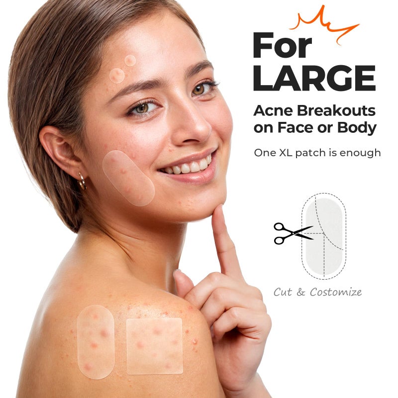 TKTK Large Pimple Patches for Face, 60 x 30 mm XL Acne Patches, Big Hydrocolloid Bandages for Body, Back, Forehead, Chin, Neck Blemish Zit Breakouts (Oval, Square, Dot 5 Sizes 124 Count) - Image 3