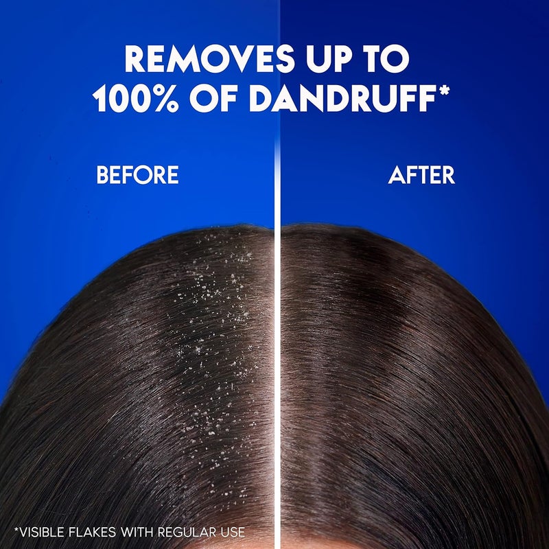 Head & Shoulders Classic Clean Anti-Dandruff Shampoo for Normal Hair, 190 ml - Image 2