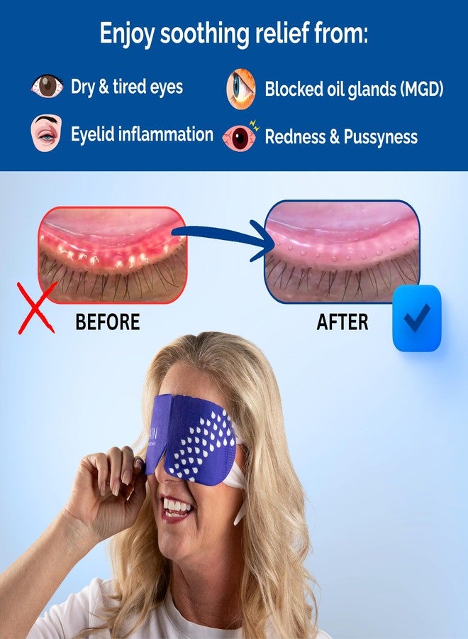 Rain Heated Eye Mask for Dry Eyes - Steam Eye Mask - Self Heating Warm Compress for Dry Eyes Relief, Stye Treatment, Moist Heat - Disposable, Unscented, No Microwave, Travel Ready, Spa (20 Masks) - Image 4