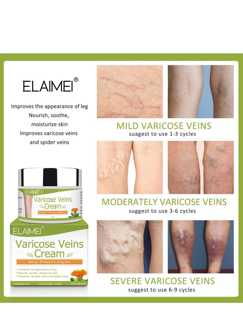 Elaimei Varicose Veins Cream, Reduces Varicose and Spider Veins, Relieves Heavy and Tired Legs – Improves Circulation and Leg Appearance with Relaxing Formula 50g - Image 3