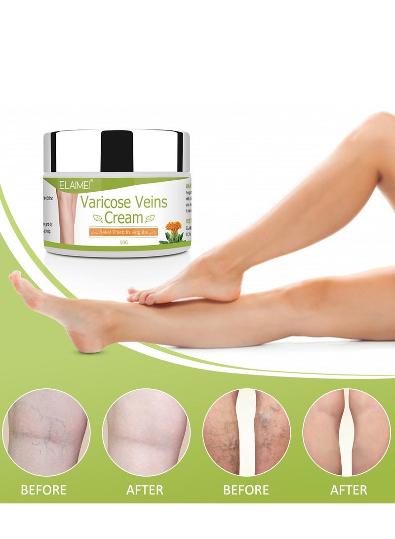Elaimei Varicose Veins Cream, Reduces Varicose and Spider Veins, Relieves Heavy and Tired Legs – Improves Circulation and Leg Appearance with Relaxing Formula 50g - Image 4