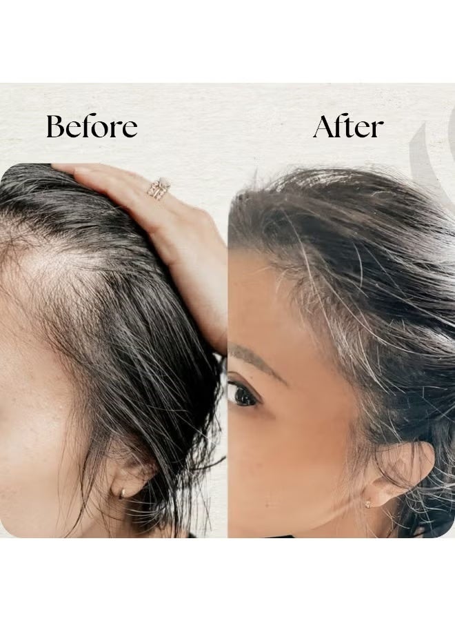 Noa NAWAH Anti-Hair Loss Lotion Enriched by Date Kernel Oil 200ml - Image 4
