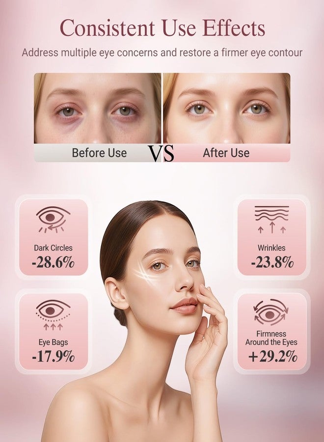 Lanieney علاج العين بالضوء الأحمر، قناع لاسلكي لعلاج منطقة تحت العين بالضوء الأحمر مع وظيفة مؤقتة، 3 أوضاع لعلاج انتفاخات العين والهالات السوداء والخطوط الدقيقة، قناع منزلي قابل لإعادة الشحن للعناية بالبشرة - Image 3