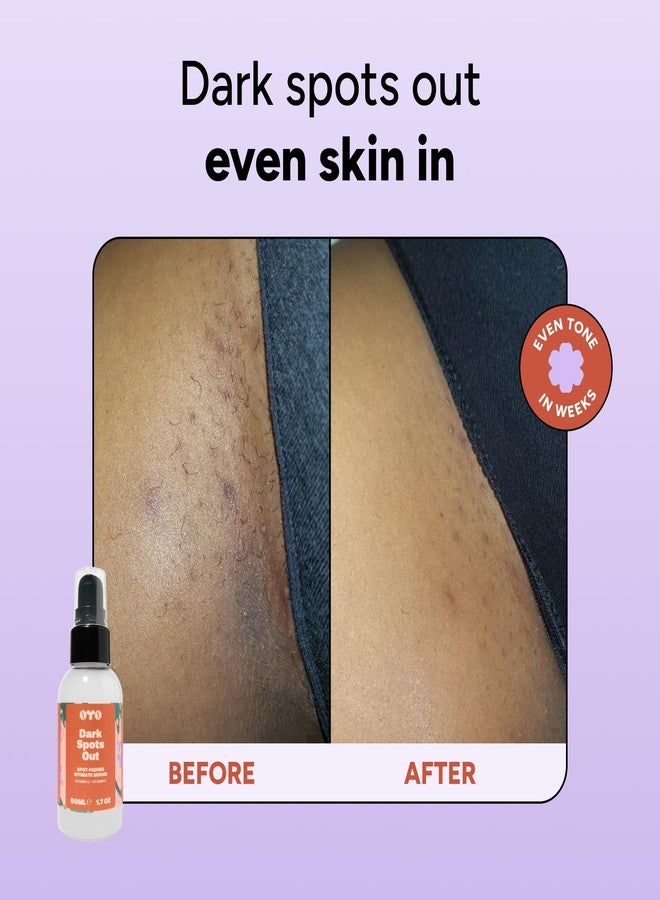 oyo Dark Spots Out by OYO – Dark Spot Remover for Bikini Area, Underarms & Intimate Skin, Vitamin C + Niacinamide Brightening Serum for Sensitive Skin, 30 mL - Image 3