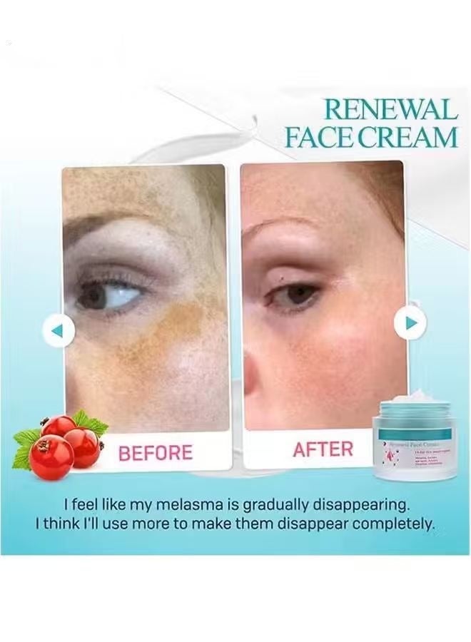 كريم تجديد البشرة، كريم التجميل لعلاج البقع الداكنة، كريم تجديد البشرة 50 جرام لعلاج البقع الصبغية والندوب للجميع أنواع البشرة، كريم تجديد البشرة ضد التجاعيد، كريم تجديد البشرة الكوري. - Image 2